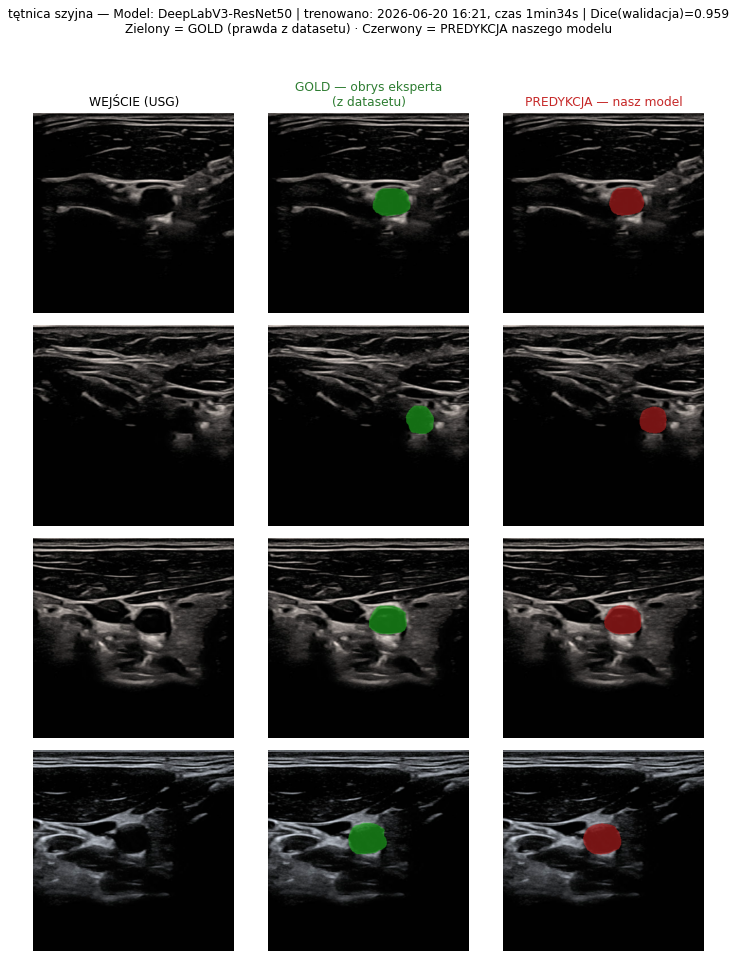 pred carotid